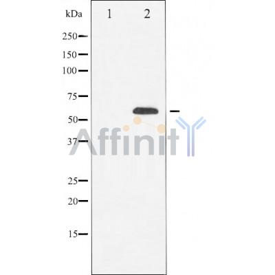 Tubulin beta Antibody