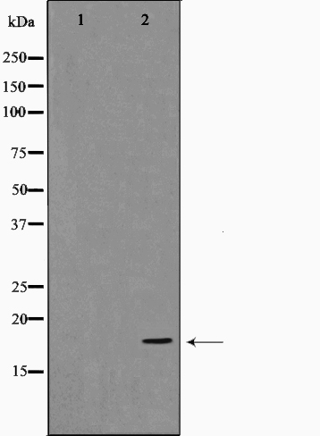 Cofilin Antibody