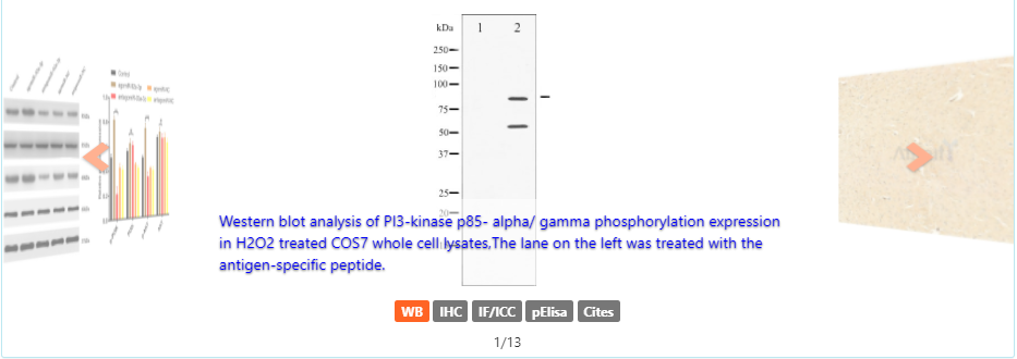 Phospho-PI3K p85 (Tyr458)[Tyr467]/p55 (Tyr199) Antibody