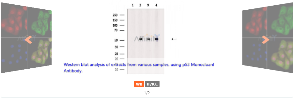 p53 Mouse monoclonal Antibody