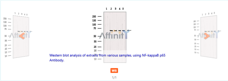 p65 Mouse Monoclonal Antibody 