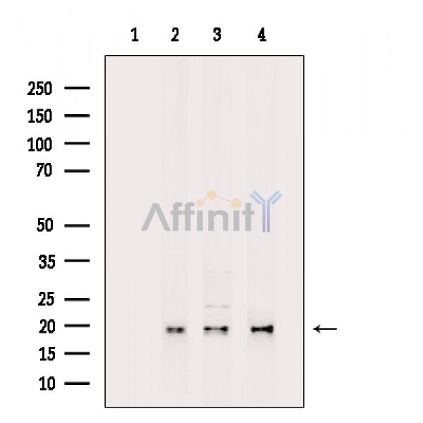 DDIT3/CHOP mouse monoclonal Antibody