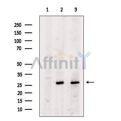 Bcl-2 Antibody