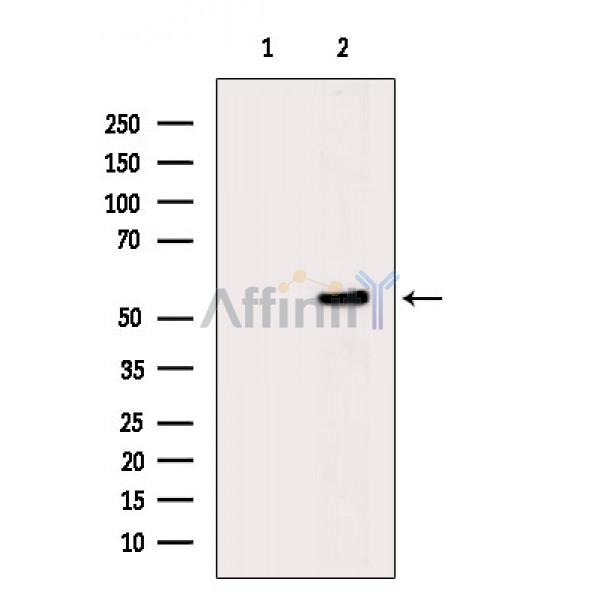 Phospho-pan-AKT1/2/3 (Ser473) Antibody