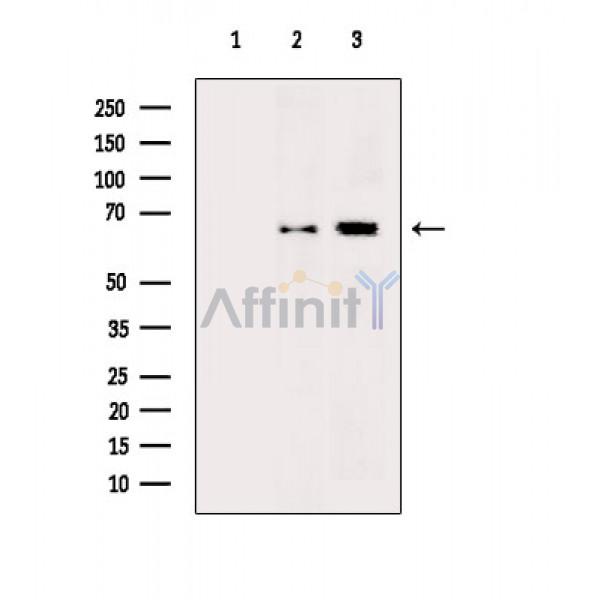 NF-kB p65 Antibody