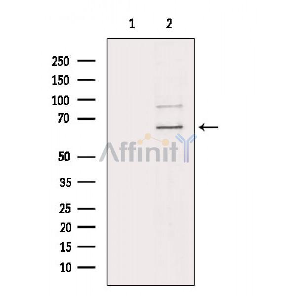 Phospho-NF-kB p65 (Ser536) Antibody