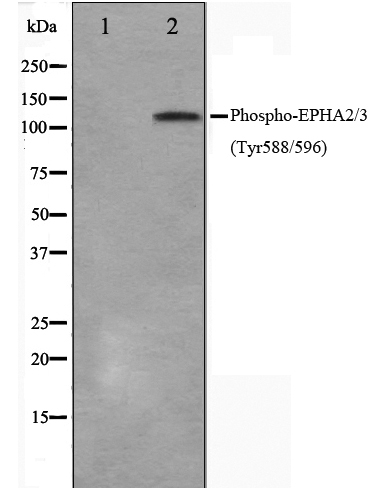 Phospho-EPHA2/3/4 (Tyr588/Tyr596) Antibody