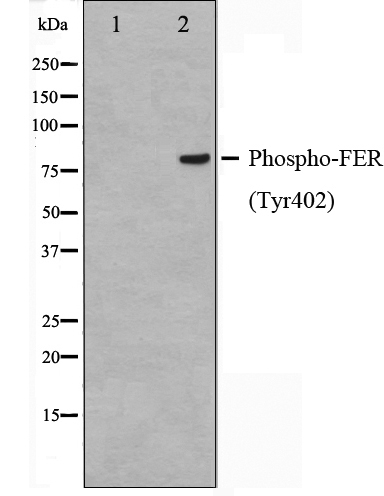 磷酸氢 FER （Tyr402） 抗体