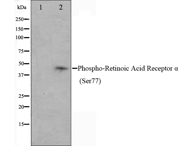磷酸-视黄酸受体α（Ser77）抗体