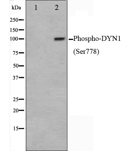 磷酸-DYN1 （Ser778） 抗体