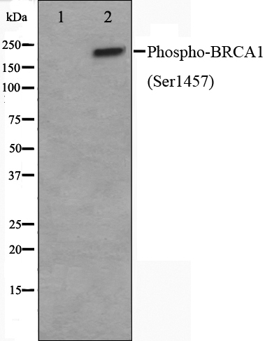 Phospho-BRCA1 (Ser1457) Antibody 