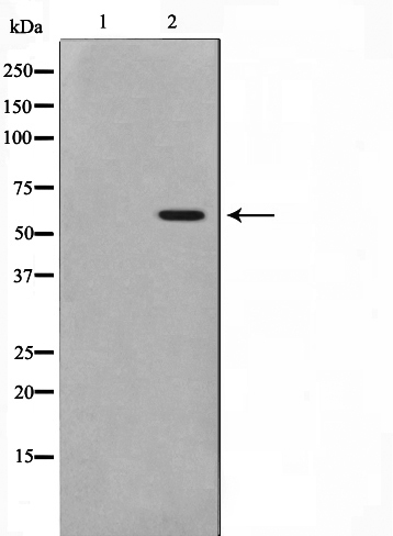 Phospho-MAPKAPK5 (Thr182) Antibody