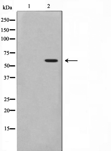 Phospho-MAPKAPK5 (Thr182) Antibody