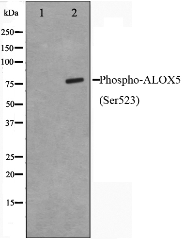 Phospho-5 Lipoxygenase (Ser523) Antibody