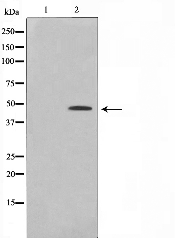 Phospho-CtBP1 (Ser422) Antibody 