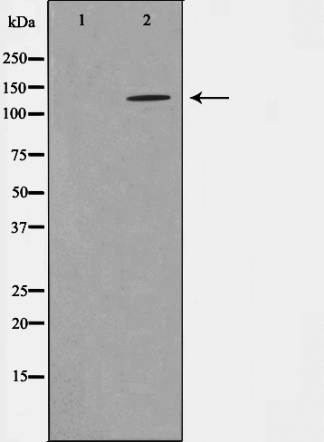 Phospho-NMDAR1 (Ser897) Antibody