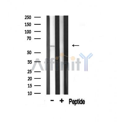 Phospho-AKT1 (Thr308) Antibody