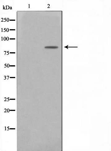 Phospho-BTK (Tyr223) Antibody 