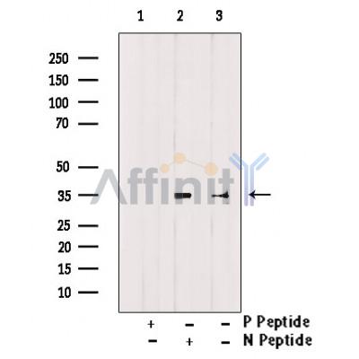 Phospho-Cyclin D1 (Thr286) Antibody