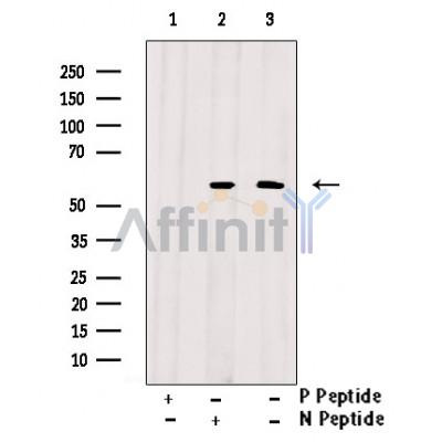 Phospho-pan-AKT1/2/3 (Tyr315/Tyr316/Tyr312) Antibody