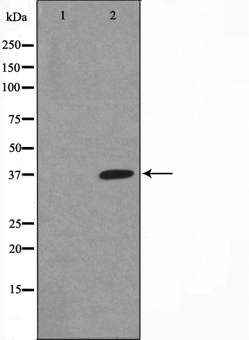 Phospho-IKB alpha (Ser32/Ser36) Antibody