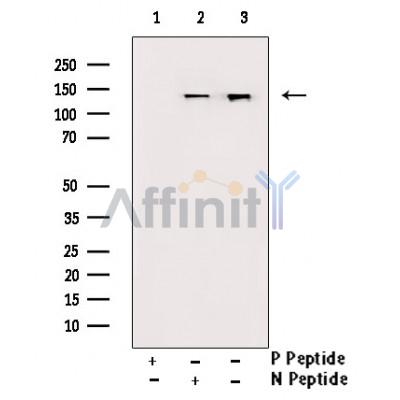 Phospho-JAK1 (Tyr1022/Tyr1023)[Tyr1034/Tyr1035] Antibody