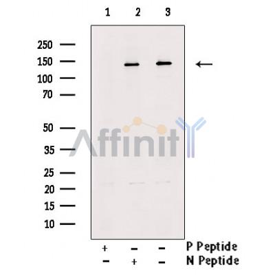 Phospho-ULK1 (Ser317) Antibody