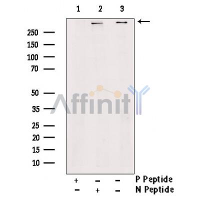 Phospho-RYR2 (Ser2814) Antibody