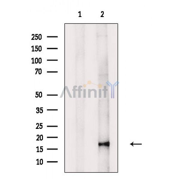 Phospho-4E-BP1 (Ser65/Thr70) Antibody