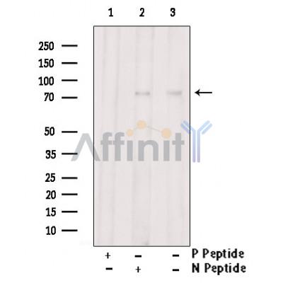 Phospho-GRK2 (Ser29) Antibody