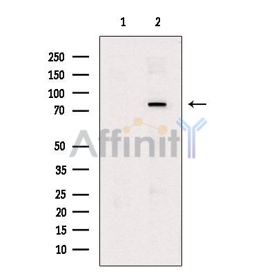 Phospho-BTK (Tyr551) Antibody