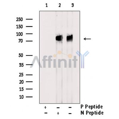 Phospho-ALK (Tyr1604) Antibody