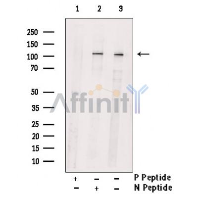 Phospho-PKD2 (Ser812) Antibody