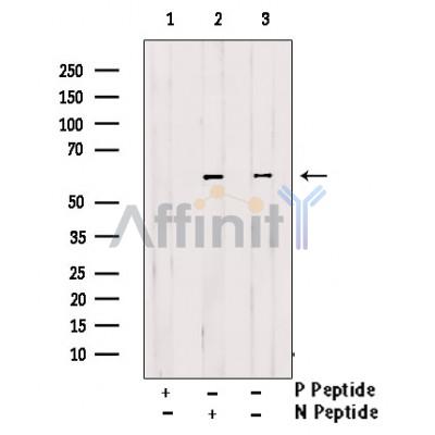 Phospho-CDC25B (Ser151) Antibody