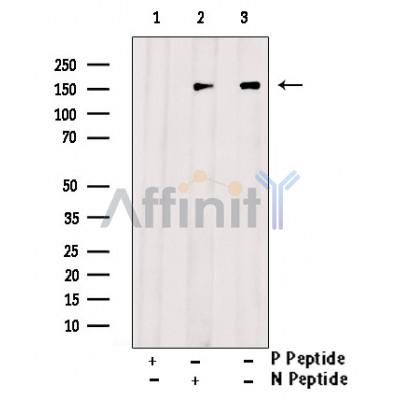 Phospho-AS160 (Ser318) Antibody