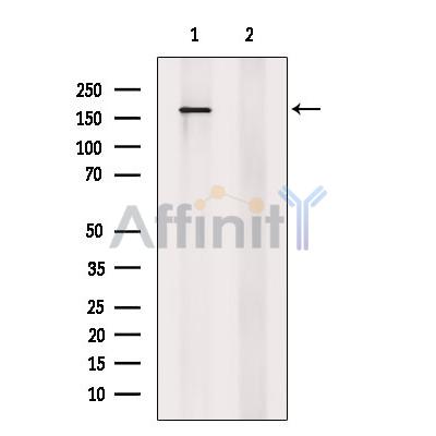 Phospho-AS160 (Ser588) Antibody