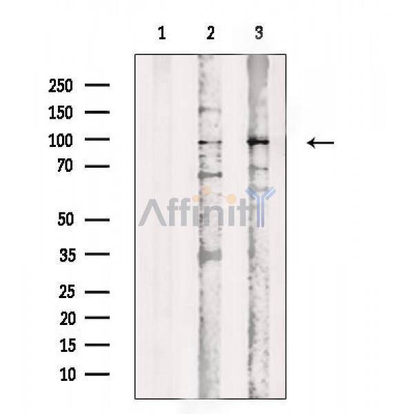 Phospho-BAP1 (Ser592) Antibody