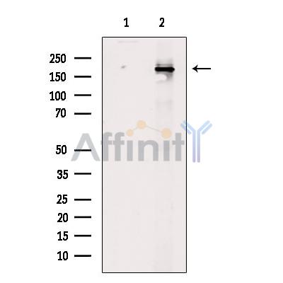 Phospho-BCL9L (Ser915) Antibody