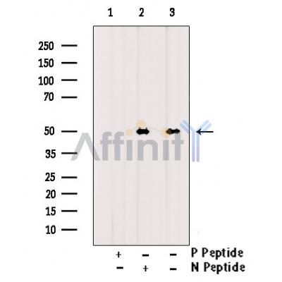 Phospho-CaMKII (Tyr231) Antibody