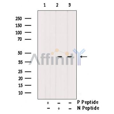 Phospho-CD79A (Tyr182) Antibody