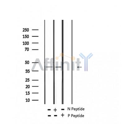 Phospho-CrkL (Tyr207) Antibody